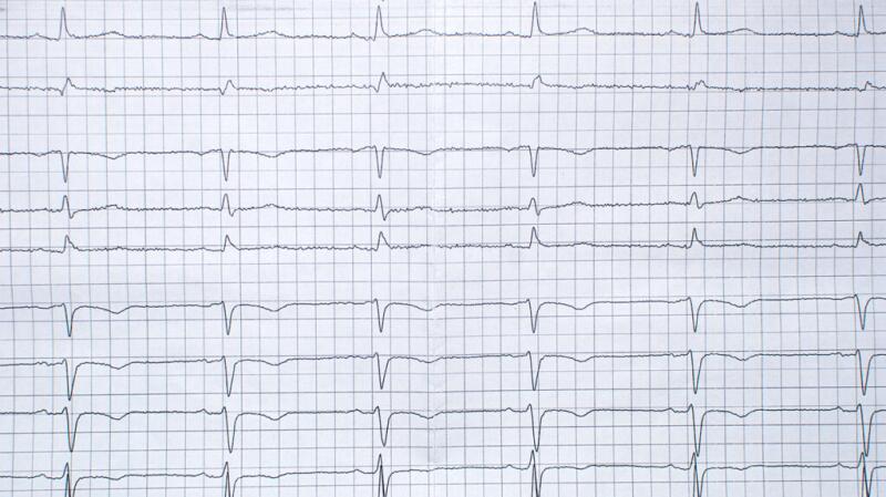 Systolic Heart Failure: Symptoms, Causes, and More