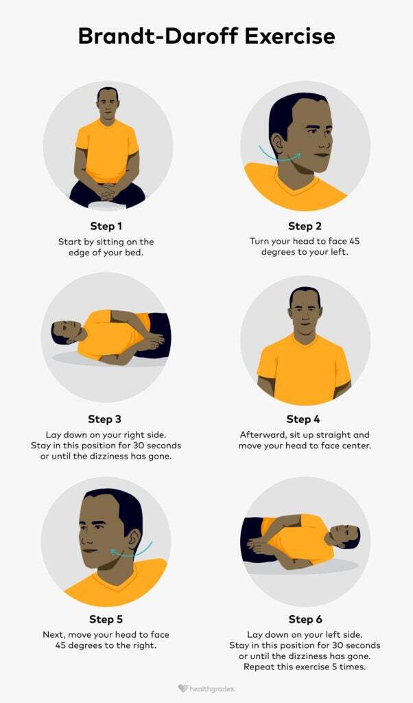 Bppv Brandt Daroff Exercises