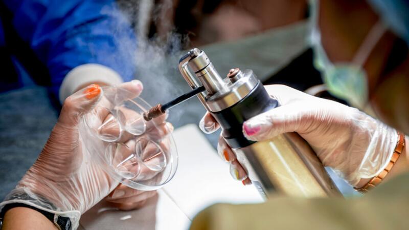 Doctor using cryotherapy canister