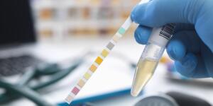 Close-up of lab technician's hand in glove holding vial with urine sample next to color strip