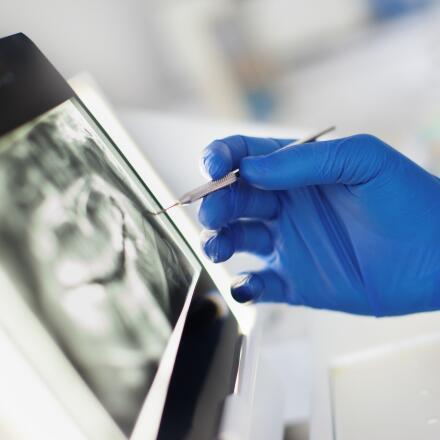 Learn about types of dental X-rays and when you need them.