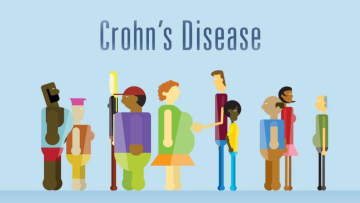 Crohn's Disease Rash: Pictures, Causes, and Treatment