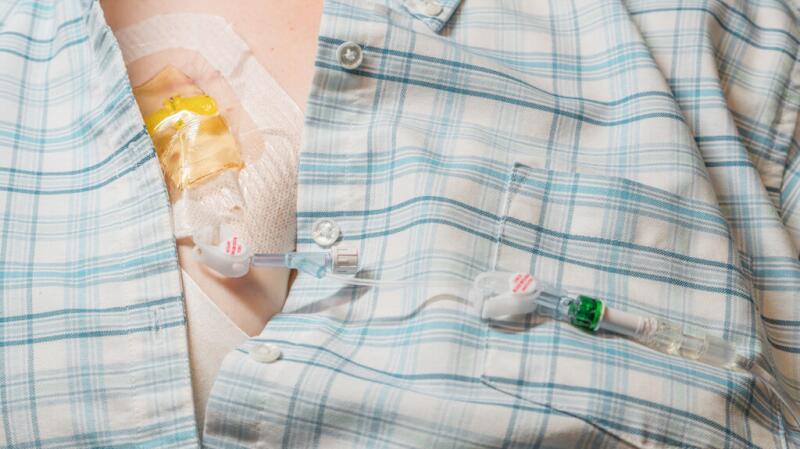 Chemo Port: Definition, Benefits, and Risks