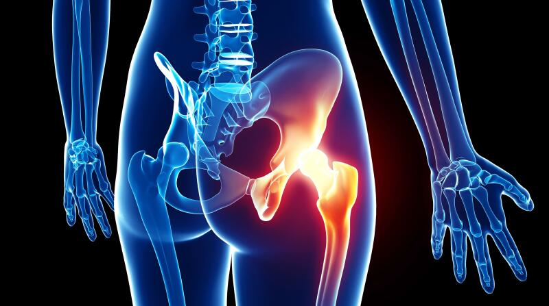 5 Common Causes of Hip Pain, Hartford Hospital